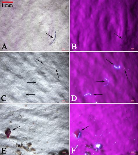 Microplastic Particles On Filters Observed With And Without A Uv Download Scientific Diagram