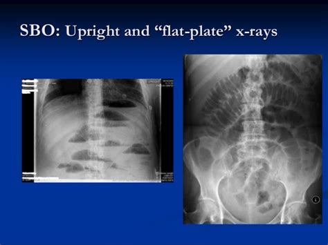 Examining The Acute Abdomen