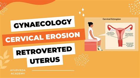 Cervical Erosion L Retroverted Uterus L Causes L Symptoms L Treatment L