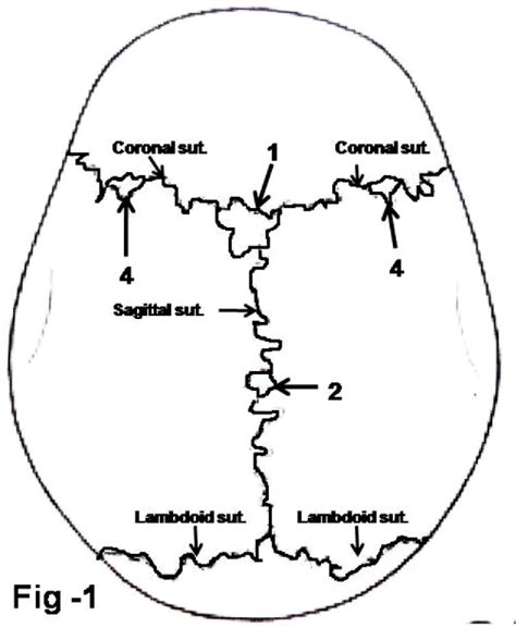 Figure 1 from Occurrence of Sutural Bones in Adult Human Skulls ...