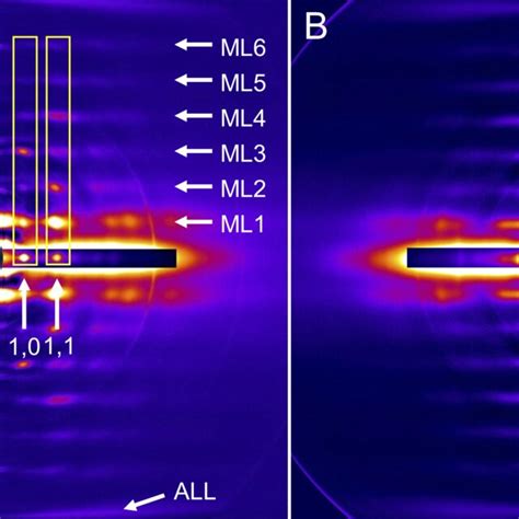 X Ray Diffraction Patterns Of Rat Sol A And Edl B Intact Muscles