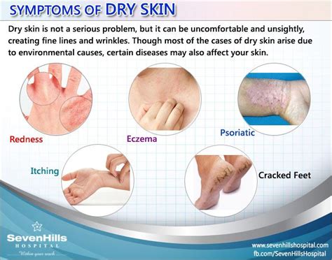 Symptoms Of Dry Skin Dryskin Symptomsdryskin Dry Skin Symptoms Food For Dry Skin Dry Skin