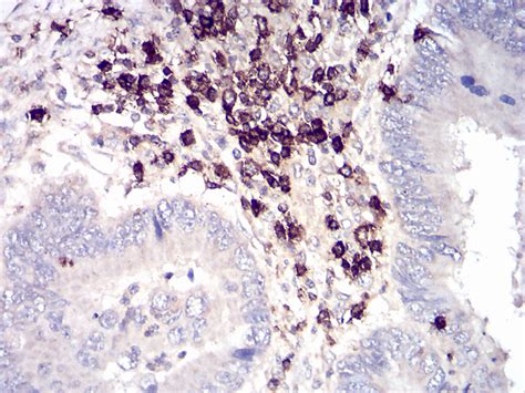 Cd Antibody Purified Mouse Monoclonal Antibody Wb Ihc Fc Icc E