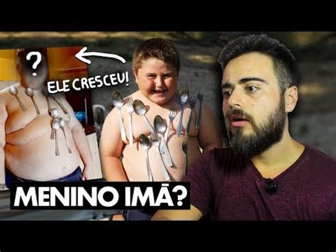 ELE CRESCEU O QUE ACONTECEU O MENINO IMÃ MISTÉRIO DESVENDADO