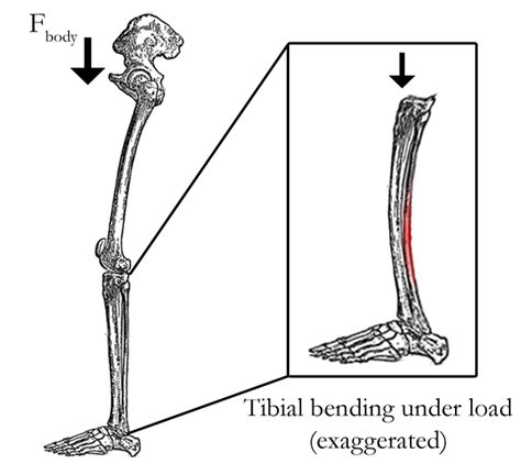 Injury Series Tibial Stress Fractures And Stress Reactions The Role