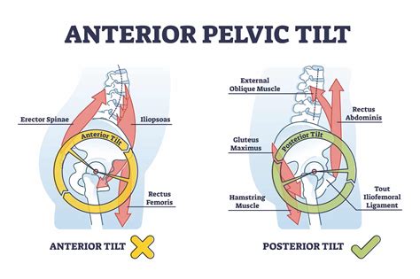 Information On Femoroacetabular Impingement Syndrome Treatments Joint