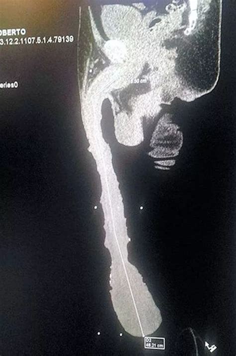 Man With Worlds Longest Penis Has Weighed His Manhood On Scales To Prove Its Real Mirror