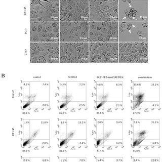 Induction Of Apoptosis And Necrosis In Prostate Cancer Cells After