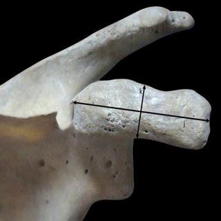 Photograph showing Dimensions of coracoid process (j: Length of ...