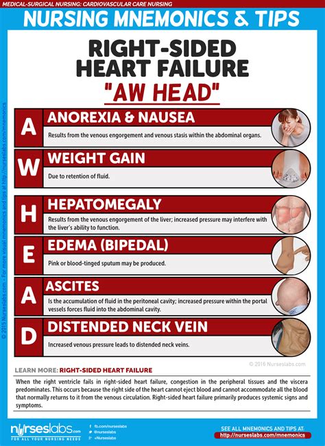 Cardiovascular Care Nursing Mnemonics And Tips Nurseslabs