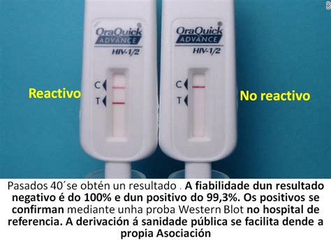 Prueba RÁpida Vih En Fluido Oral Na AsociaciÓn Lazos Ferrol Lazos Pro Solidariedade