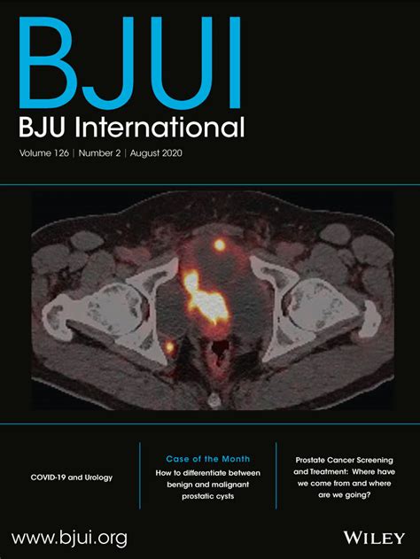 A Comparative Propensity Score‐matched Analysis Of Perioperative