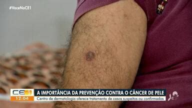 CETV 1ª Edição Fortaleza Especialista alerta os cuidados para