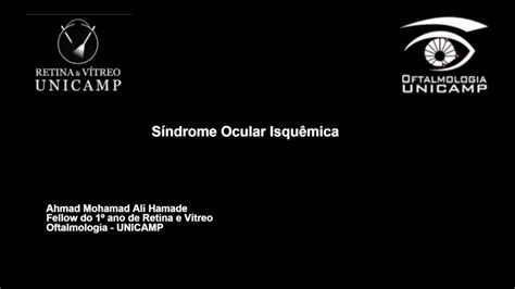 Retina E V Treo S Ndrome Ocular Isqu Mica Youtube