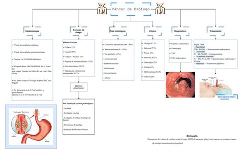 Cáncer de Esófago MARIA JOSE BAEZ DE LA TORRE uDocz