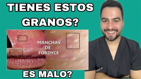 C Mo Tratar Las Manchas En Los Labios Genitales Causas Y Soluciones