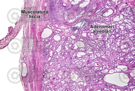 Uomo Prostata Sezione Trasversale 15X Uomo Mammiferi Apparato