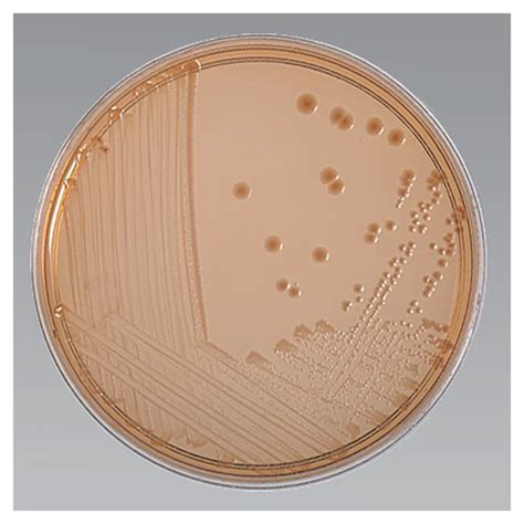 MacConkey Agar With Sorbitol