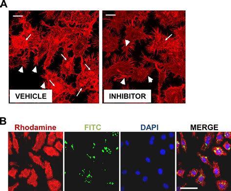 High Throughput Fluorometric Technique For Assessment Of Macrophage