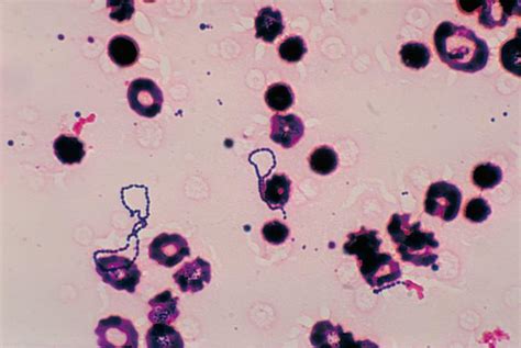 STREPTOCOCCUS VIRIDANS CARACTERÍSTICAS CICLO DE VIDA E SINTOMAS