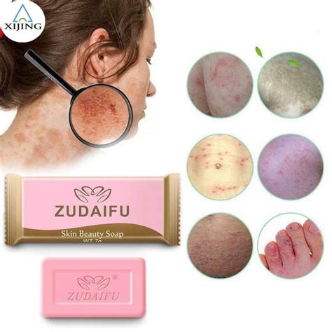 Jual Yiganerjing Sabun Sulfur Penyakit Eksim Anti Bakteri Psoriasis