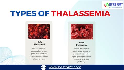 Ppt Understanding Of Thalassemia Powerpoint Presentation Free