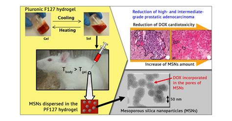 Doxorubicin Functionalized Silica Nanoparticles Incorporated Into A