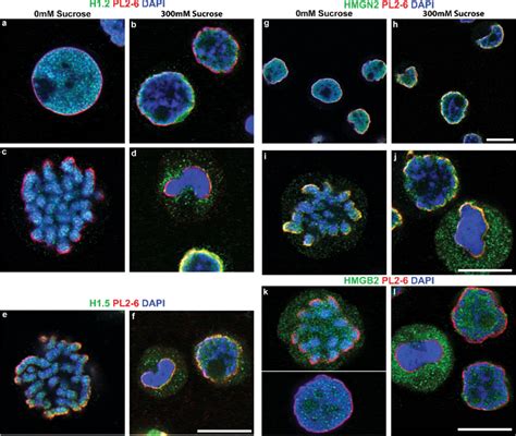 Select Chromatin Proteins In Hyperosmotic Sucrose Incubated Hl 60s4