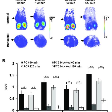 In Vivo Pet Imaging And Quantitative Image Analysis Of Subcutaneous