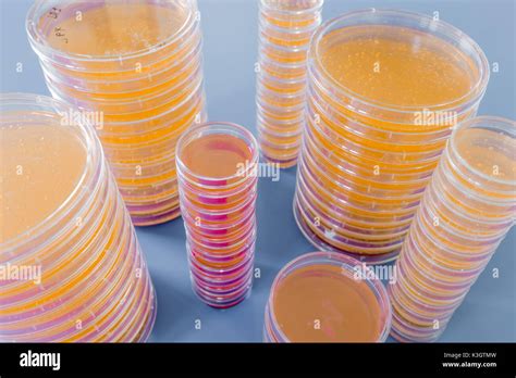 Blut Agar Platte Stockfotos Und Bilder Kaufen Seite Alamy