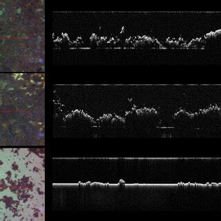 Optical Microscopy Left And Cross Sectional Oct Two Dimensional D