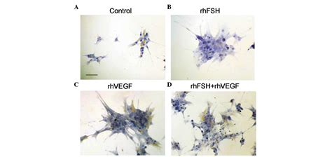 Vascular Endothelial Growth Factor Induces Anti‑müllerian Hormone