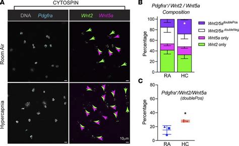 Jci Insight Hypercapnia Alters Stroma Derived Wnt Production To Limit