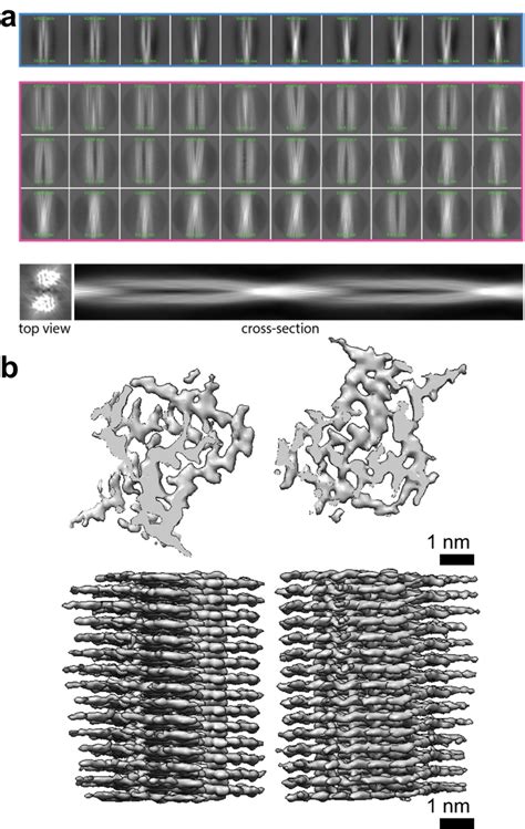 Cryoelectron Microscopy Image Processing And D Model Generation For