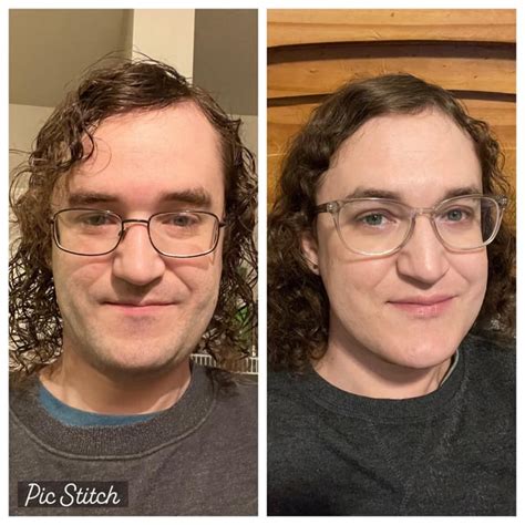 Finally Starting To See Her Day 3 Hrt Vs 7 Months Rtranstimelines