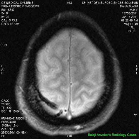 Dr Balaji Anvekar Frcr Cord Sign In Cvt