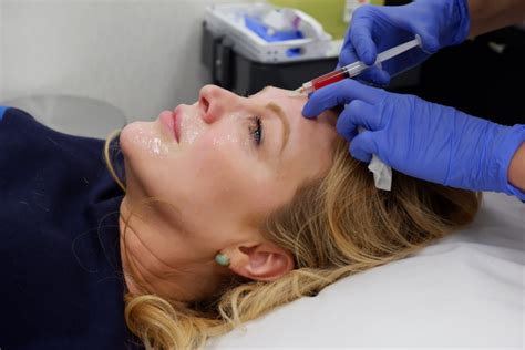 The Prf Facial The Iv Health Centre