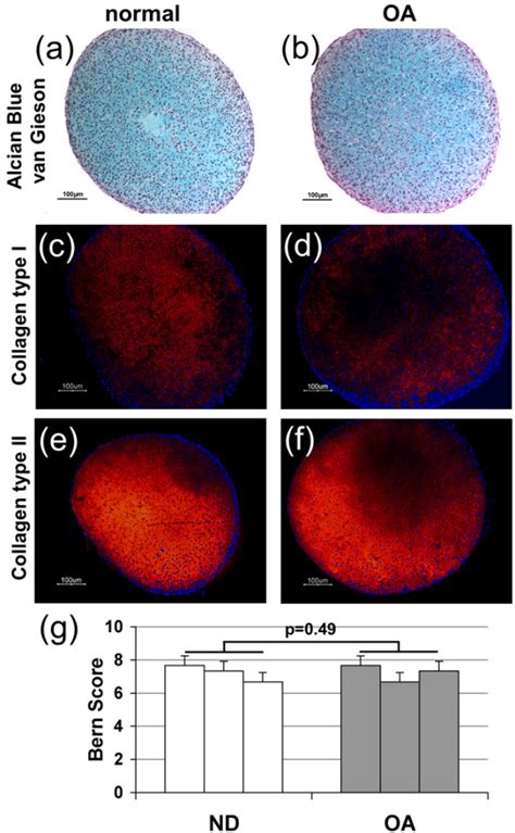 Histology Of Normal Donor And Osteoarthritic Chondrocyte Pellet