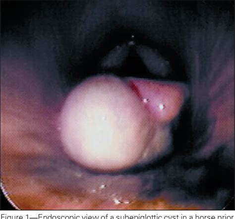 Figure From Use Of Intralesional Formalin Administration For