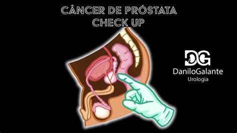 Câncer de próstata Check up YouTube