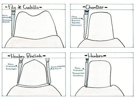 Líneas de Terminacion Escuela de higiene dental Odontología