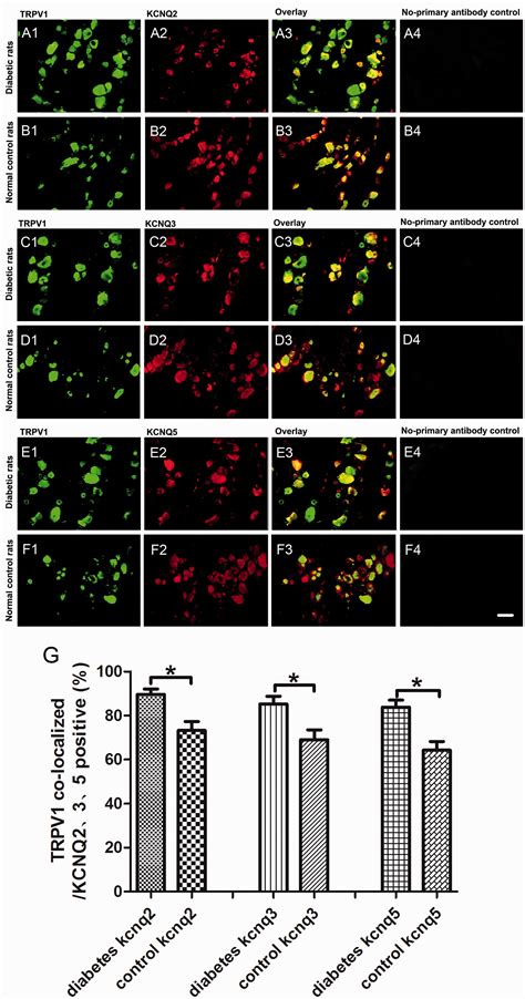 Kcnq235 Channels In Dorsal Root Ganglion Neurons Can Be Therapeutic