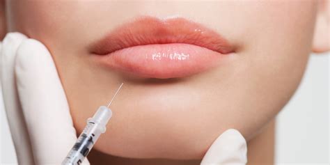 Facial Fillers and Injections Are the Biggest Trends in Plastic Surgery | SELF