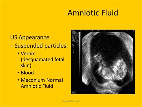 14 Amniotic Fluid Imaging Dr Ahmed Esawy