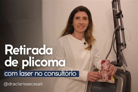 Avanços no Tratamento do Plicoma Anal Laser CO2