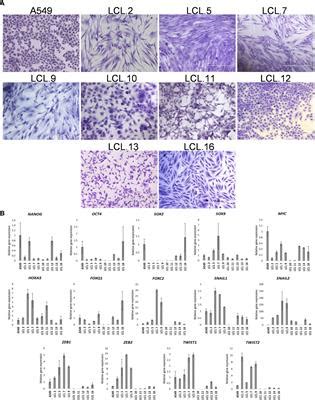 Frontiers Crosstalk Between Protein Kinases AKT And ERK1 2 In Human