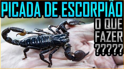 Picada de Escorpião Aprenda o que Fazer Butantan YouTube