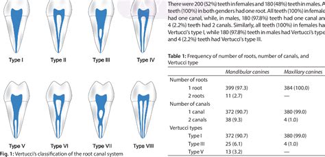 rák Melléktermék Egység maxillary canine root canal növekedés Bárki ...