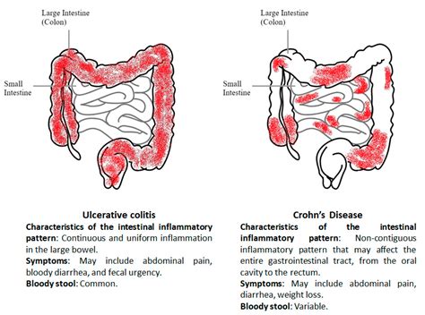 New Insights Into Inflammatory Bowel Diseases From Proteomic And