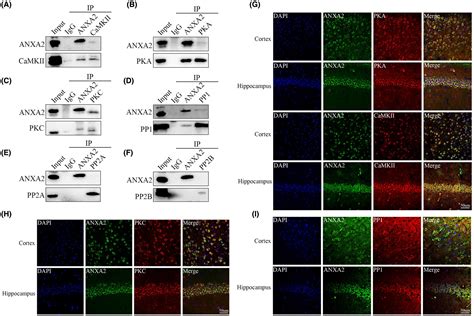 Inhibition Of ANXA2 Activity Attenuates Epileptic Susceptibility And